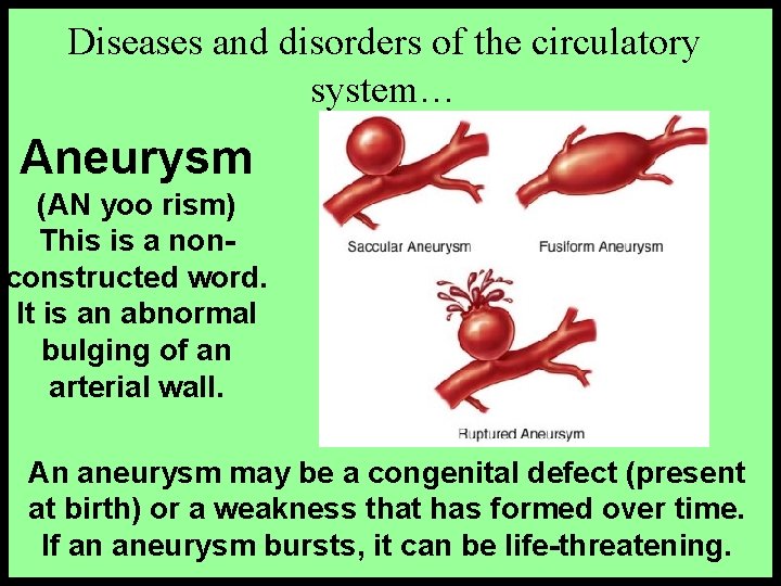 Diseases and disorders of the circulatory system… Aneurysm (AN yoo rism) This is a Diseases and disorders of the circulatory system… Aneurysm (AN yoo rism) This is a