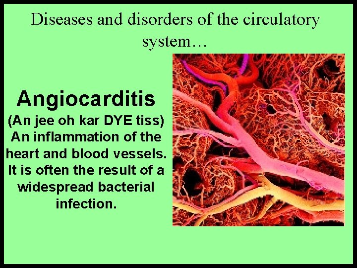 Diseases and disorders of the circulatory system… Angiocarditis (An jee oh kar DYE tiss) Diseases and disorders of the circulatory system… Angiocarditis (An jee oh kar DYE tiss)