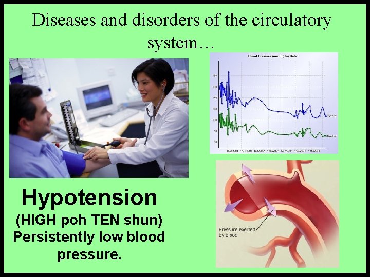 Diseases and disorders of the circulatory system… Hypotension (HIGH poh TEN shun) Persistently low Diseases and disorders of the circulatory system… Hypotension (HIGH poh TEN shun) Persistently low
