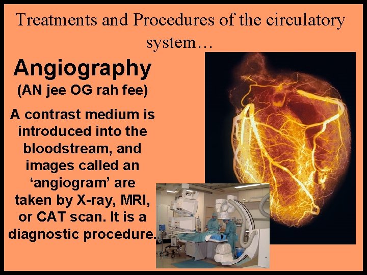 Treatments and Procedures of the circulatory system… Angiography (AN jee OG rah fee) A Treatments and Procedures of the circulatory system… Angiography (AN jee OG rah fee) A