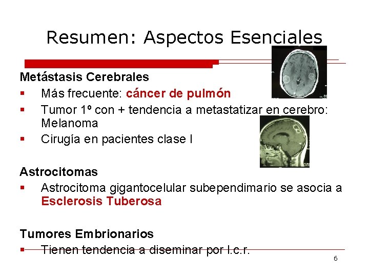 Resumen: Aspectos Esenciales Metástasis Cerebrales § Más frecuente: cáncer de pulmón § Tumor 1º