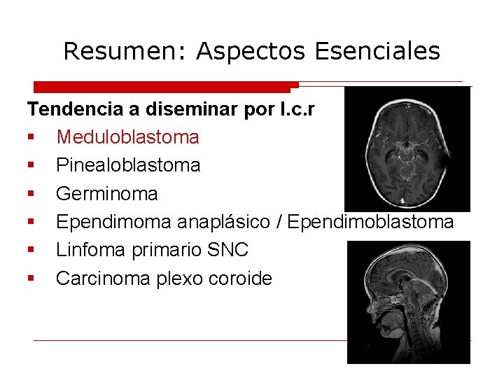 Resumen: Aspectos Esenciales Tendencia a diseminar por l. c. r § Meduloblastoma § Pinealoblastoma