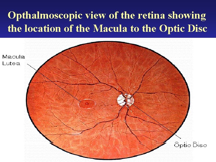Opthalmoscopic view of the retina showing the location of the Macula to the Optic