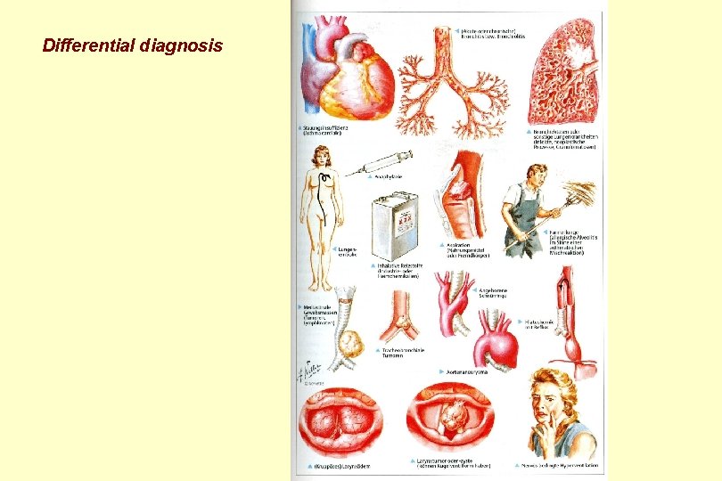 Differential diagnosis 