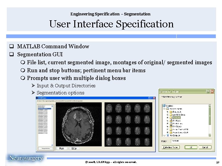 Engineering Specification – Segmentation User Interface Specification q MATLAB Command Window q Segmentation GUI