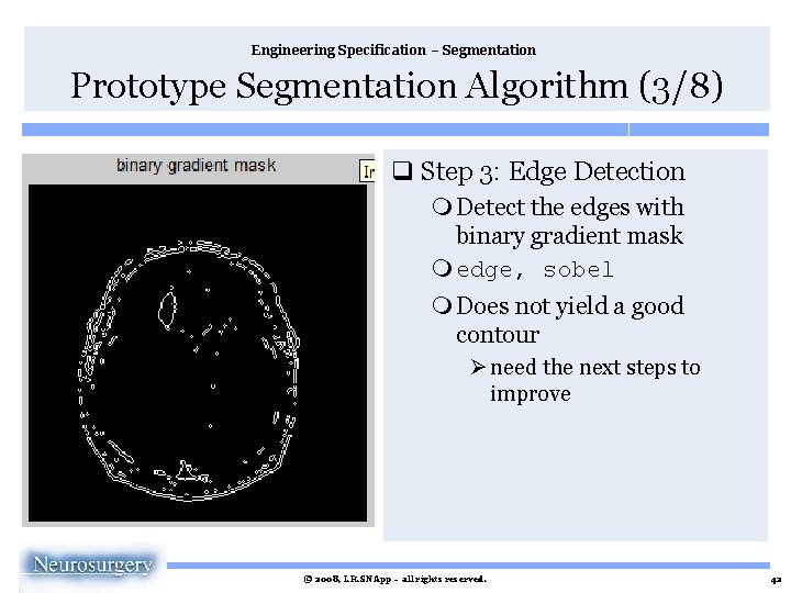 Engineering Specification – Segmentation Prototype Segmentation Algorithm (3/8) q Step 3: Edge Detection m
