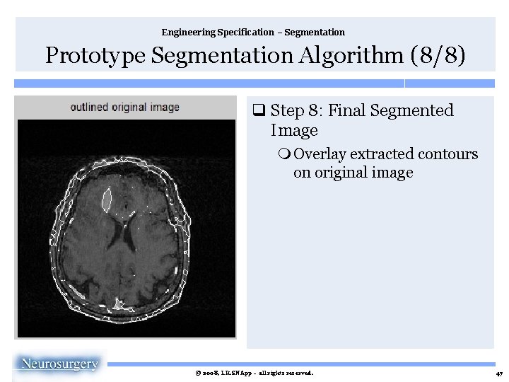 Engineering Specification – Segmentation Prototype Segmentation Algorithm (8/8) q Step 8: Final Segmented Image
