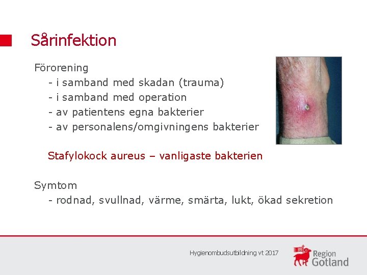 Sårinfektion Förorening - i samband med skadan (trauma) - i samband med operation -