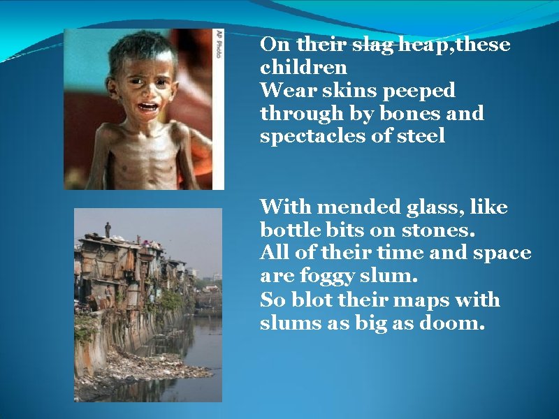 On their slag heap, these children Wear skins peeped through by bones and spectacles