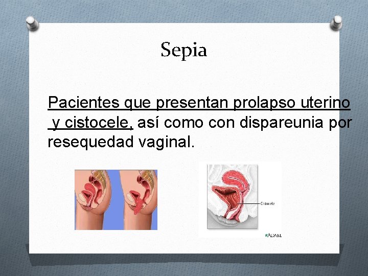 Sepia Pacientes que presentan prolapso uterino y cistocele, así como con dispareunia por resequedad