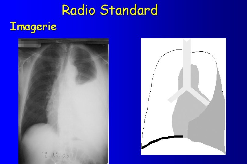 Imagerie Radio Standard 