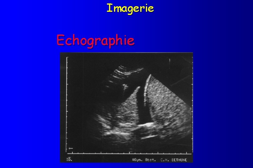 Imagerie Echographie 