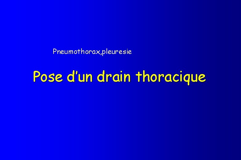 Pneumothorax, pleuresie Pose d’un drain thoracique 