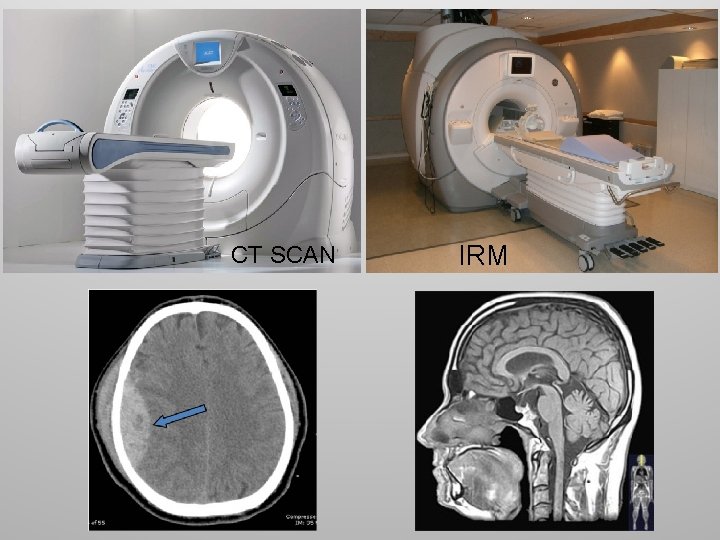 CT SCAN IRM 