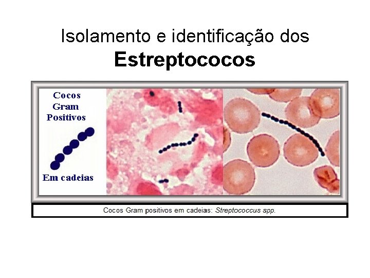 Isolamento e identificação dos Estreptococos 