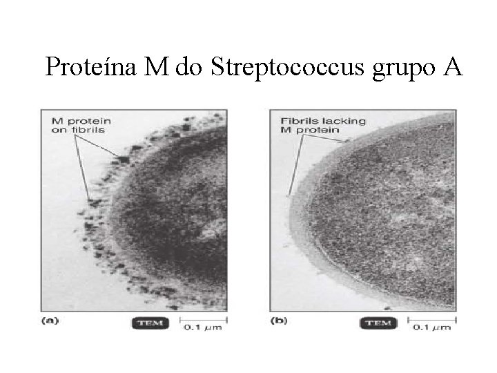 Proteína M do Streptococcus grupo A 