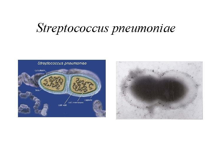 Streptococcus pneumoniae 