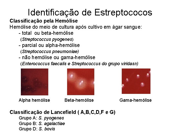 Identificação de Estreptococos Classificação pela Hemólise do meio de cultura após cultivo em ágar