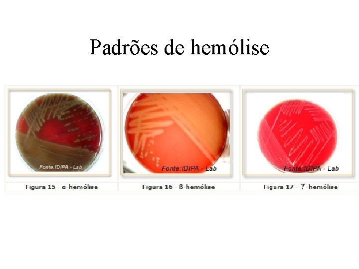 Padrões de hemólise 