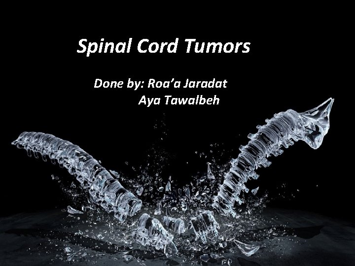 Spinal Cord Tumors Done by: Roa’a Jaradat Aya Tawalbeh 