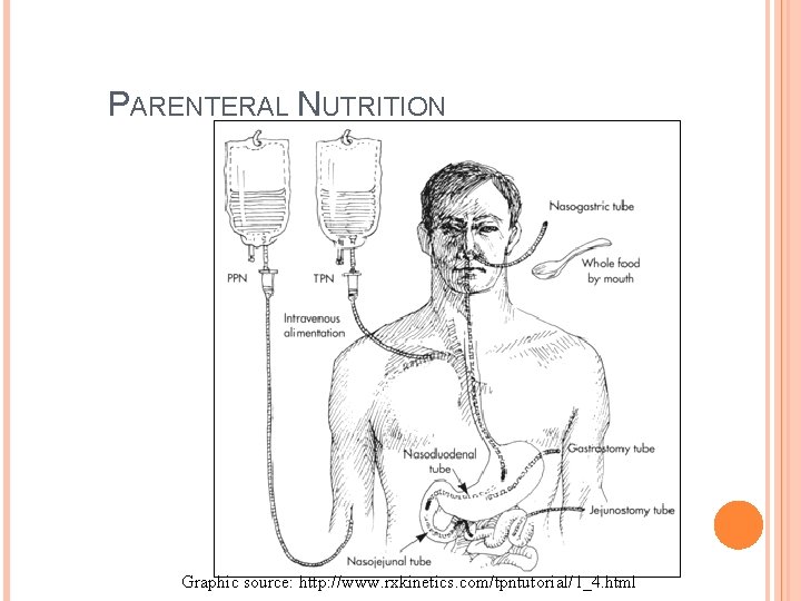 PARENTERAL NUTRITION Graphic source: http: //www. rxkinetics. com/tpntutorial/1_4. html 