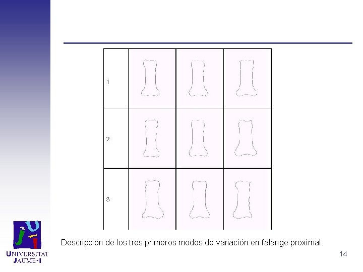 Descripción de los tres primeros modos de variación en falange proximal. 14 