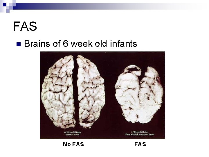 FAS n Brains of 6 week old infants No FAS 