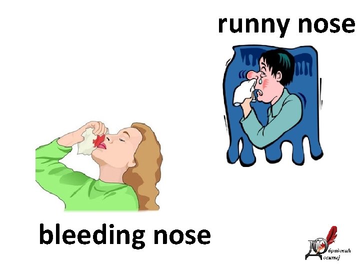 runny nose bleeding nose 