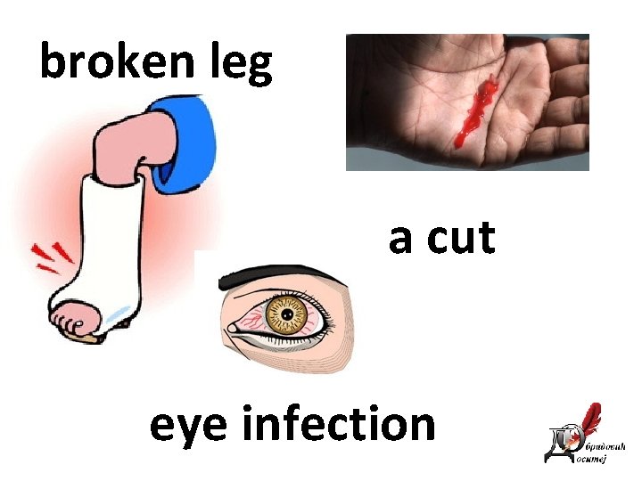 broken leg a cut eye infection 