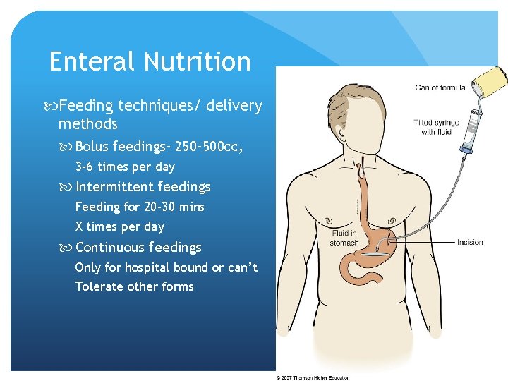 Enteral Nutrition Feeding techniques/ delivery methods Bolus feedings- 250 -500 cc, 3 -6 times
