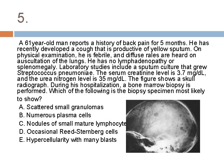 5. A 61 year old man reports a history of back pain for 5
