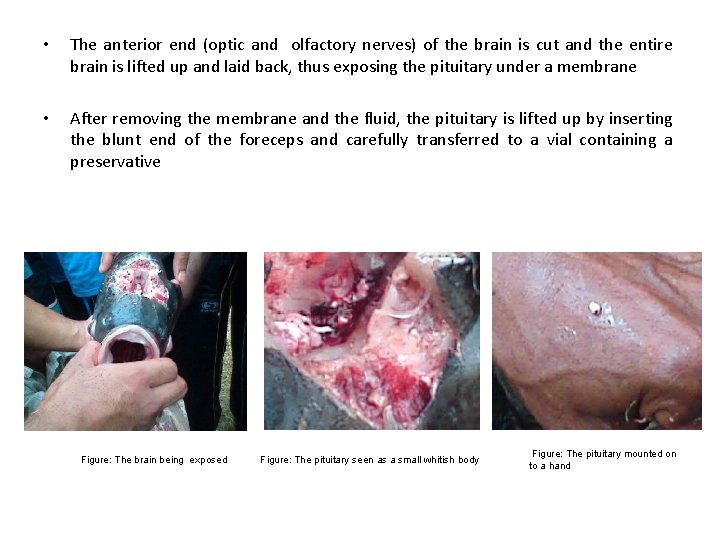  • The anterior end (optic and olfactory nerves) of the brain is cut