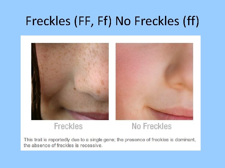 Freckles (FF, Ff) No Freckles (ff) 