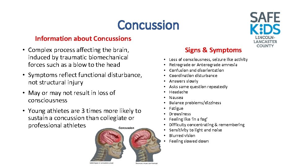 Concussion Information about Concussions • Complex process affecting the brain, induced by traumatic biomechanical