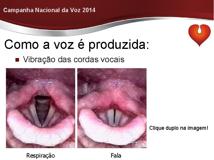 Campanha Nacional da Voz 2014 Como a voz é produzida: Vibração das cordas vocais