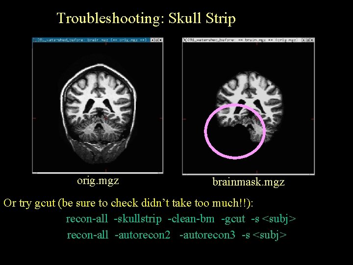 Troubleshooting: Skull Strip orig. mgz brainmask. mgz Or try gcut (be sure to check