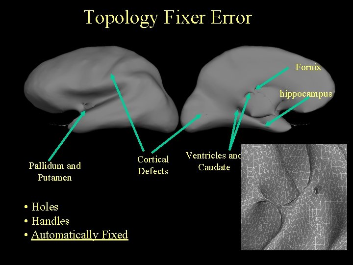 Topology Fixer Error Fornix hippocampus Pallidum and Putamen • Holes • Handles • Automatically