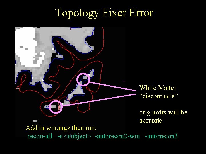 Topology Fixer Error White Matter “disconnects” orig. nofix will be accurate Add in wm.