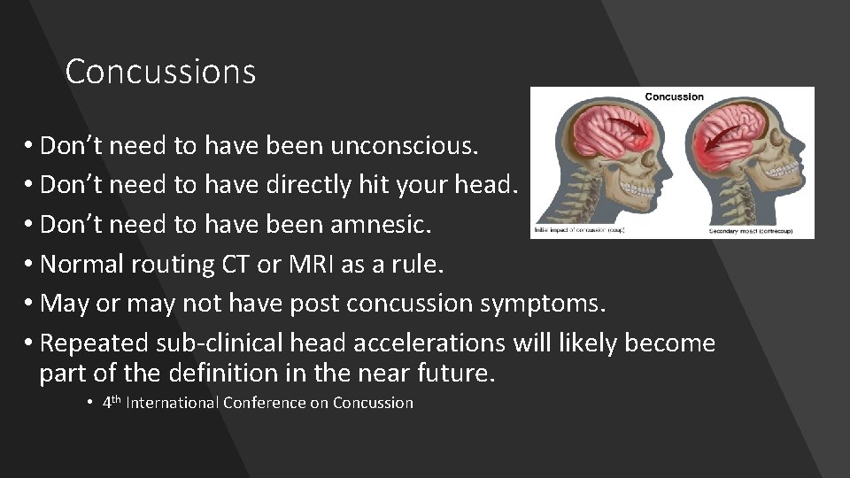 Concussions • Don’t need to have been unconscious. • Don’t need to have directly
