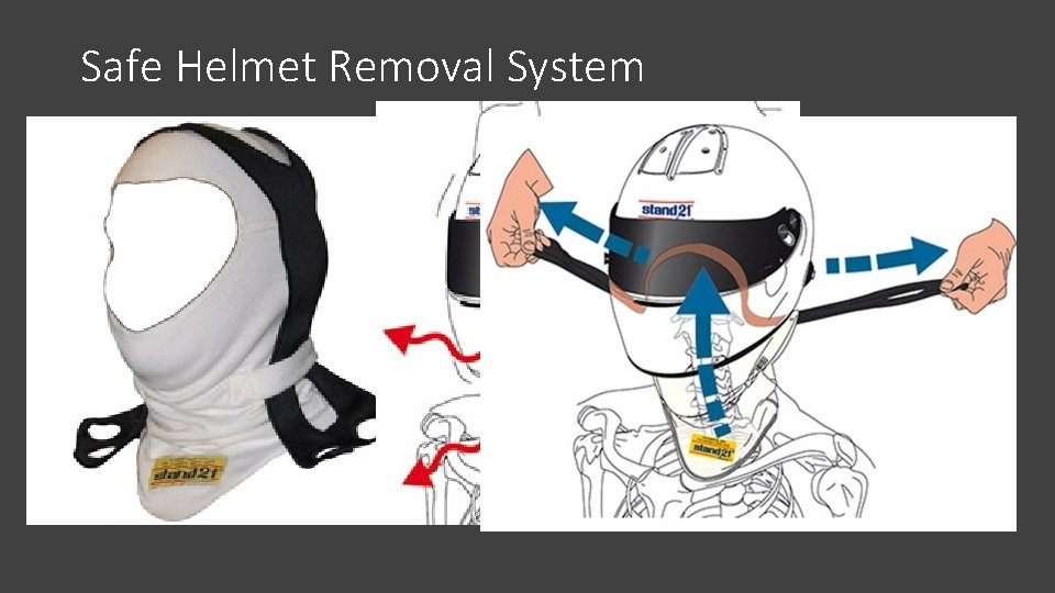 Safe Helmet Removal System 