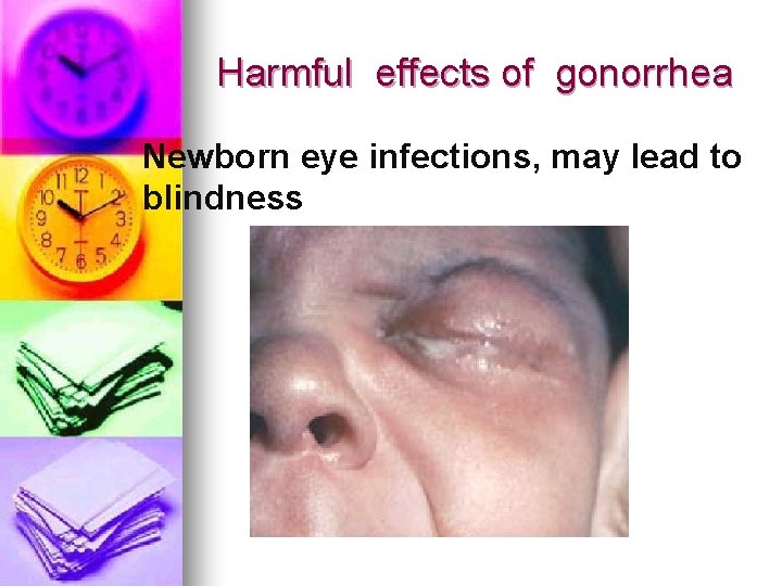 Harmful effects of gonorrhea Newborn eye infections, may lead to blindness Harmful effects of gonorrhea Newborn eye infections, may lead to blindness