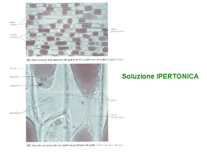 Soluzione IPERTONICA 