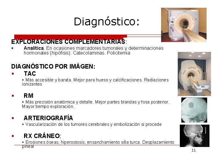 Diagnóstico: EXPLORACIONES COMPLEMENTARIAS: § Analítica. En ocasiones marcadores tumorales y determinaciones hormonales (hipófisis). Catecolaminas.