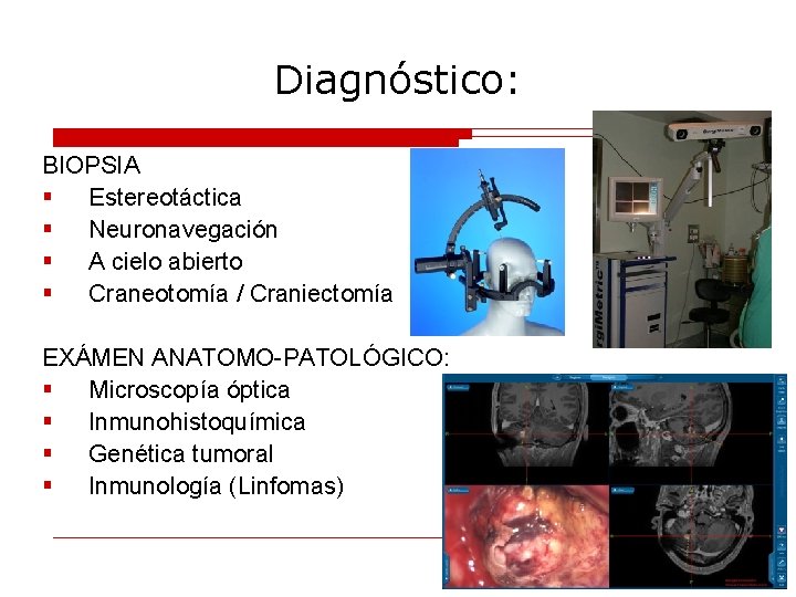 Diagnóstico: BIOPSIA § Estereotáctica § Neuronavegación § A cielo abierto § Craneotomía / Craniectomía