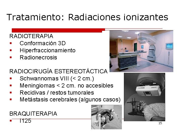 Tratamiento: Radiaciones ionizantes RADIOTERAPIA § Conformación 3 D § Hiperfraccionamiento § Radionecrosis RADIOCIRUGÍA ESTEREOTÁCTICA