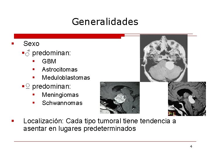 Generalidades § Sexo §♂ predominan: § § § GBM Astrocitomas Meduloblastomas §♀ predominan: §