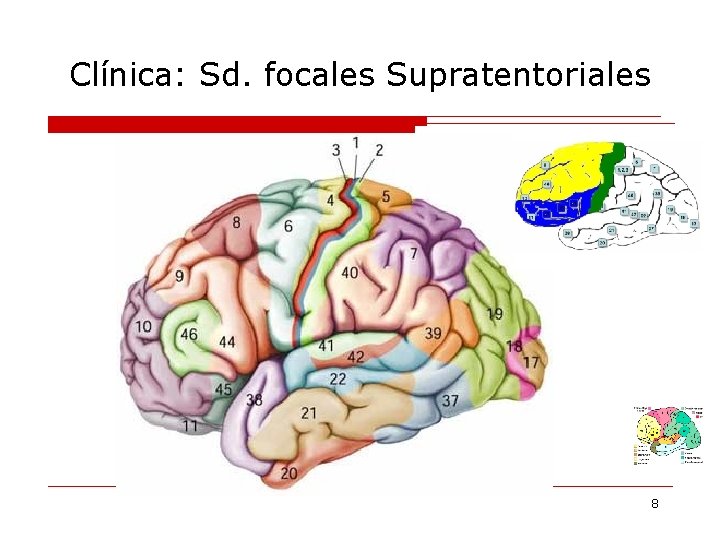 Clínica: Sd. focales Supratentoriales 8 