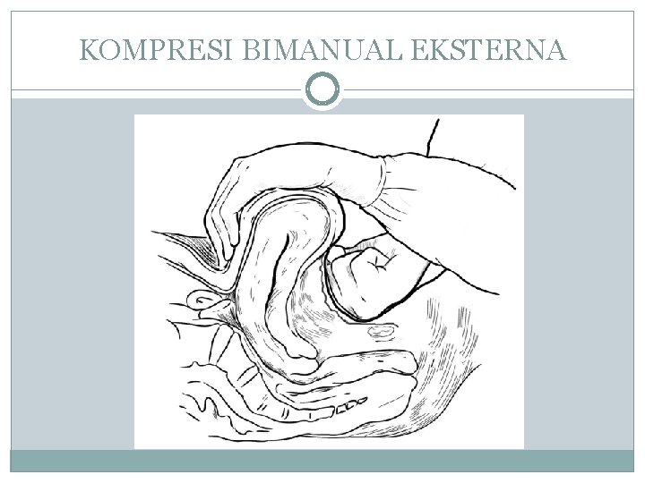 KOMPRESI BIMANUAL EKSTERNA 