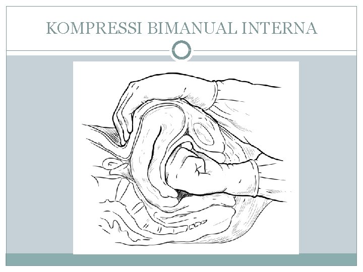 KOMPRESSI BIMANUAL INTERNA 