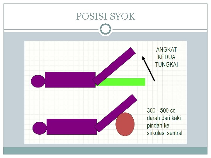 POSISI SYOK 